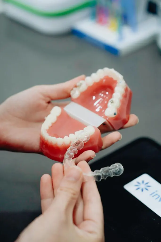Invisalign model