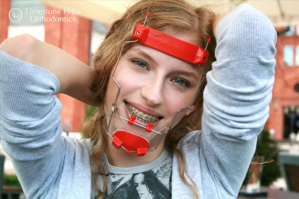 Person wearing headgear and braces, smiling with hands behind head. "Limestone Hills Orthodontics" logo in the top left corner.