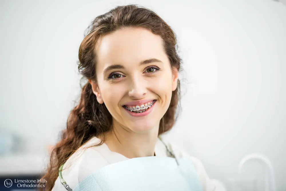 a woman smiling with braces. Retainers vs Braces in Austin, TX