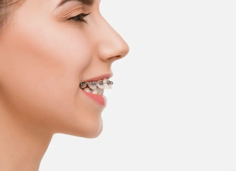 A close-up profile of a person in Austin, TX, showcasing their teeth with metal braces against a bright background.