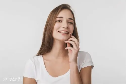 a woman smiling at the camera with metal braces illustrating How to Floss with Braces