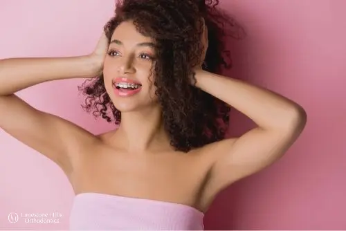 a woman posing illustrating How to Get Braces Glue Off Teeth