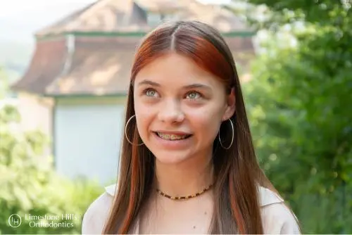 Does Insurance Pay For Braces?