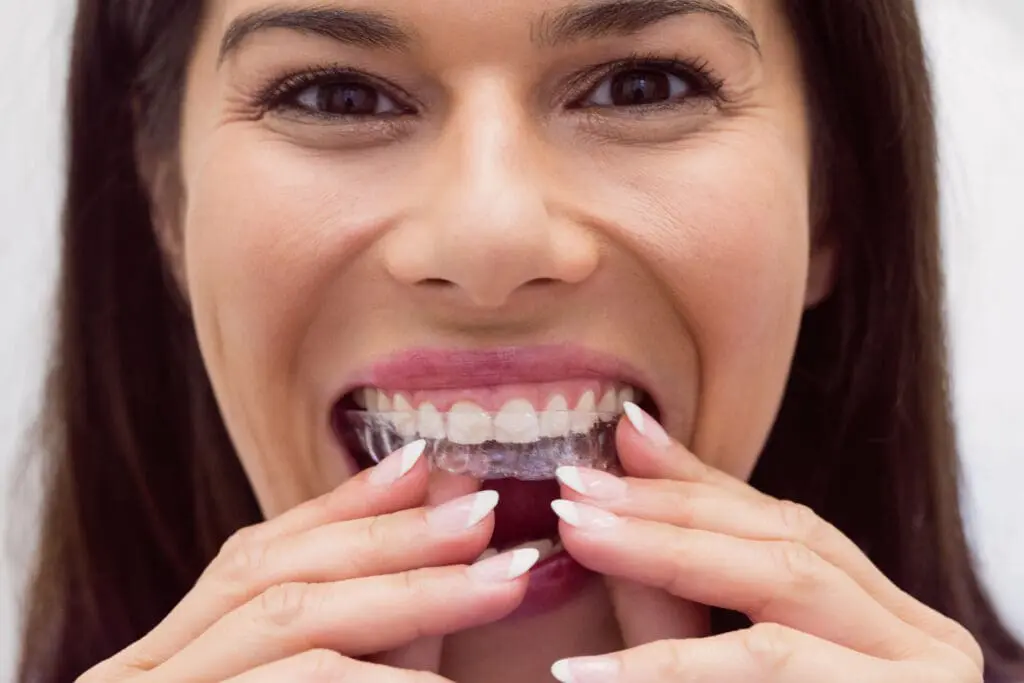 female patient wearing invisalign - Byte vs Invisalign: What Austin Patients Should Know in 2026 | Limestone Hills Orthodontics