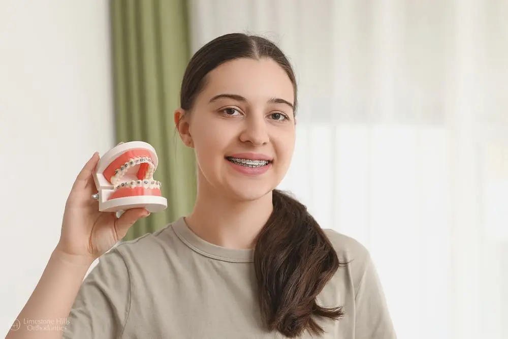 Beautiful young woman with metal braces holding a dental jaw model, orthodontic concept, to illustrate overbite vs underbite in Austin, TX