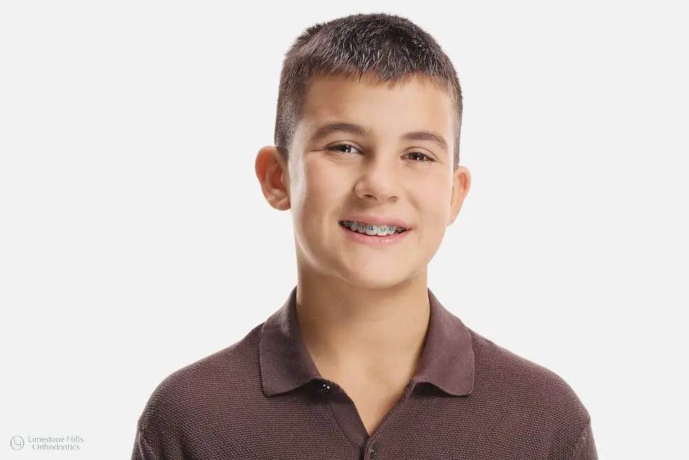 cute boy metal braces isolated white background after asking about When to See an Orthodontist for Kids