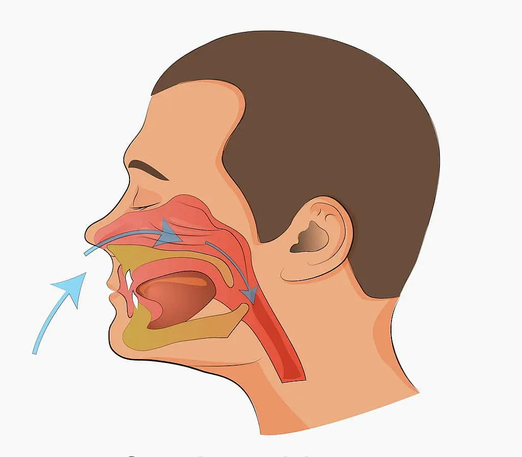 An illustration depicts a side view of a person's head, showing air flowing into the mouth (indicated by a large blue arrow) and then through the oral cavity and throat (indicated by smaller yellow arrows). The nasal passages are visible but do not show airflow. This visual representation of mouth breathing can be associated with various orthodontic issues that Limestone Hills Orthodontics in Austin, TX.