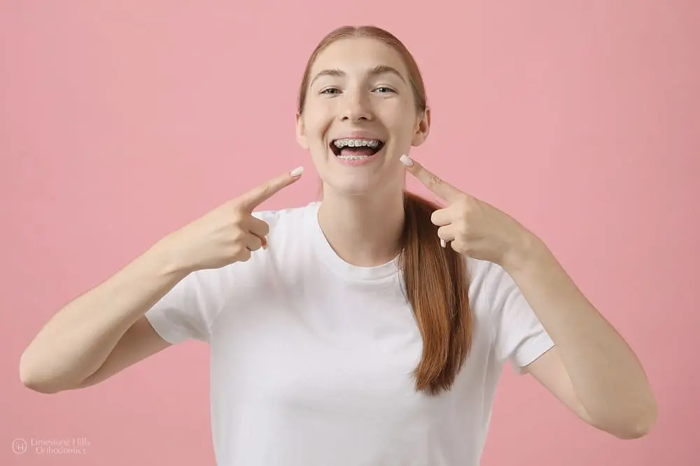 A smiling young woman, who appears to be of Caucasian descent based on her features and complexion, points to her braces. Limestone Hills Orthodontics in Austin, TX, provides orthodontic treatment.