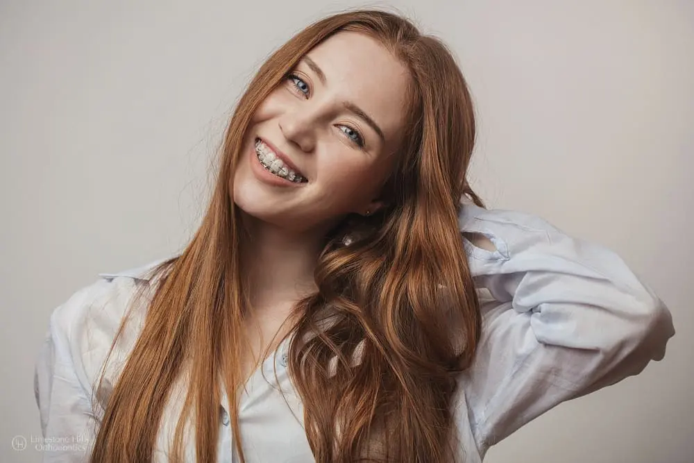 Happy young red-haired woman smiling with clear braces after she is free from risks of mail order orthodontics
