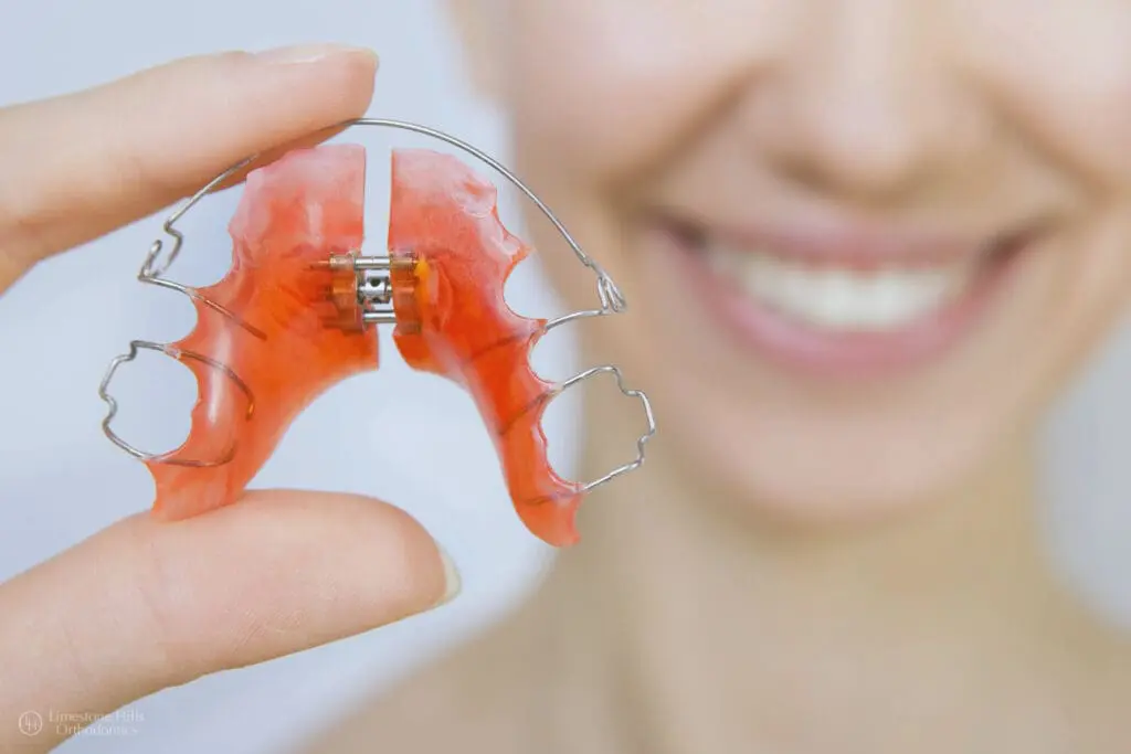 A person holds a red Palatal Expander at Limestone Hills Orthodontics in Austin, TX.