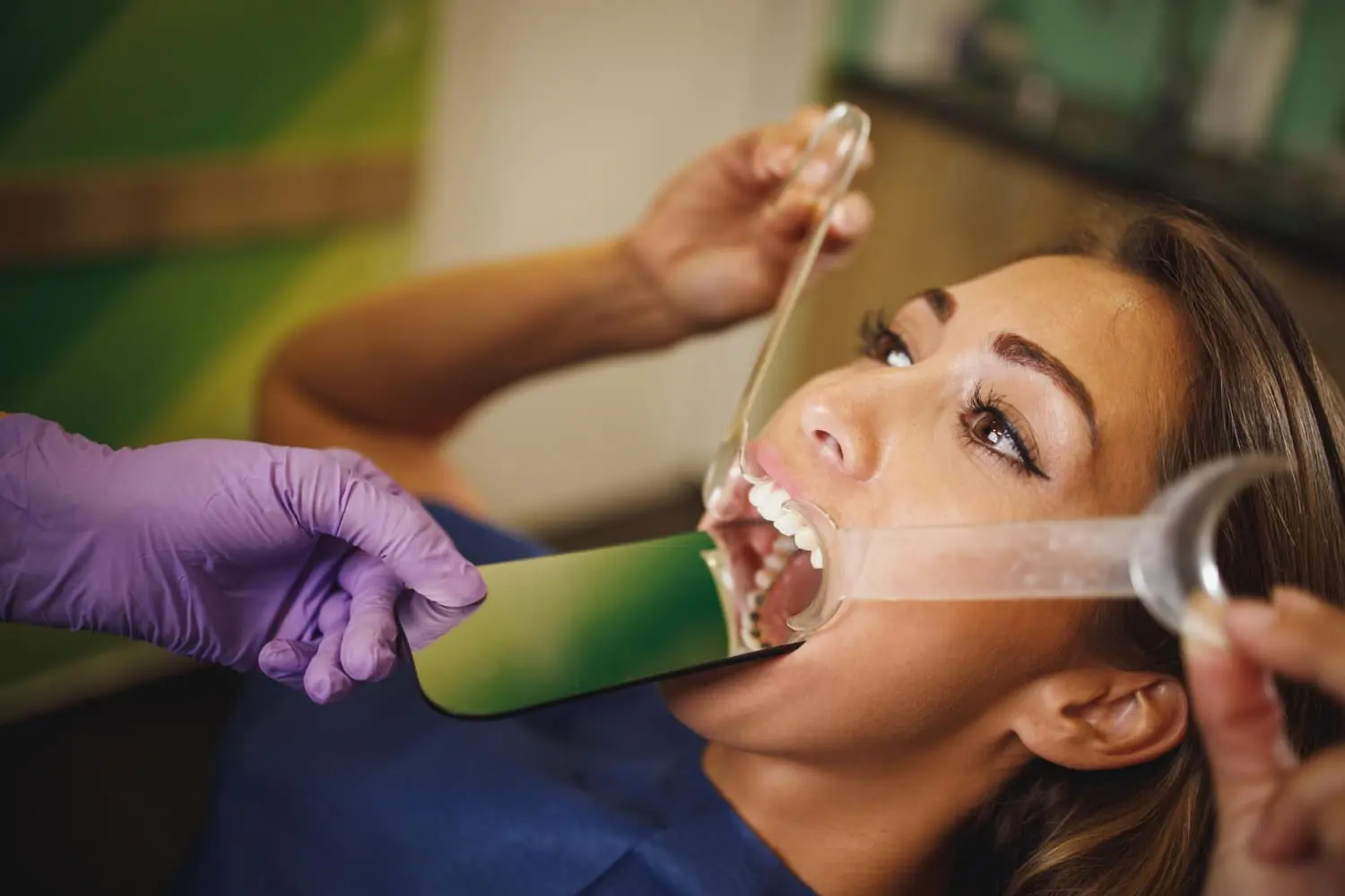A person with a dental mouth opener is having their teeth examined by gloved hands holding a mirror, as the dentist checks the alignment of recently applied lingual braces in Austin, TX