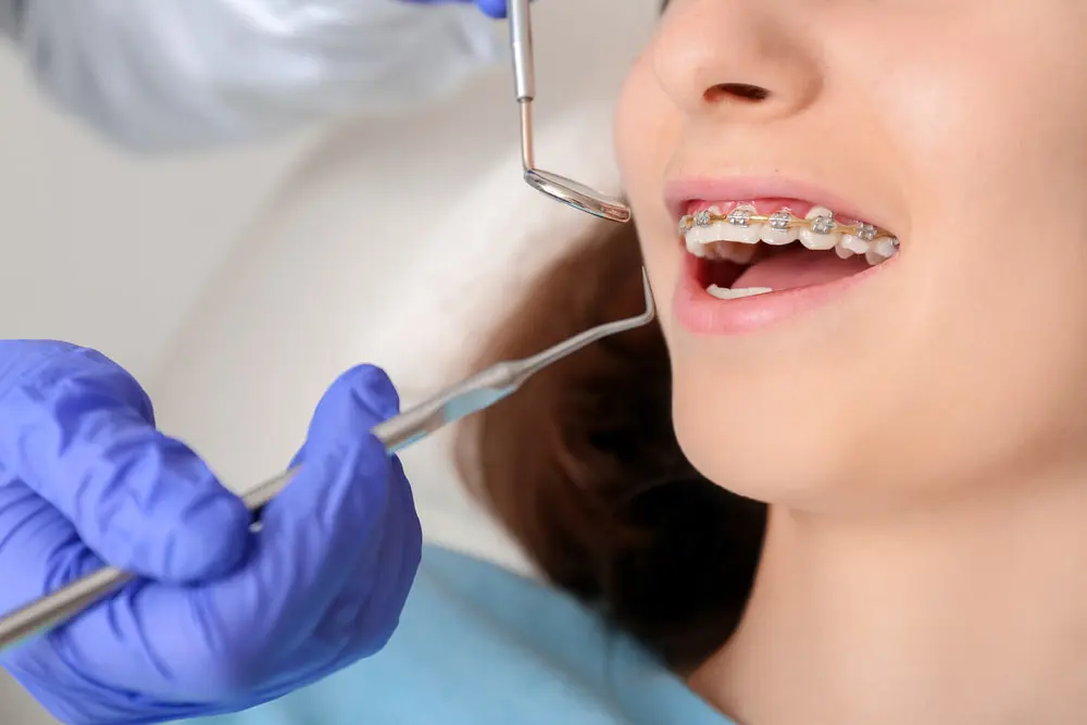 A person sporting braces is having a dental check-up. The dentist, wearing blue gloves, carefully holds dental tools near the patient's mouth in Austin