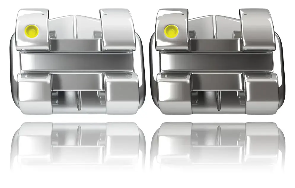 Close-up of traditional metal braces with four silver brackets, including two with yellow indicators, used at Limestone Hills Orthodontics in Austin, TX for orthodontic treatment. Close-up of traditional metal braces with four silver brackets, including two with yellow indicators, used at Limestone Hills Orthodontics in Austin, TX for orthodontic treatment.