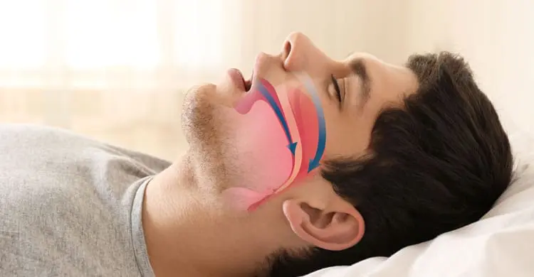 Man lying with mouth open, demonstrating airflow during mouth breathing. Limestone Hills Orthodontics in Austin, TX highlights the impact of mouth breathing on oral health and bad breath.