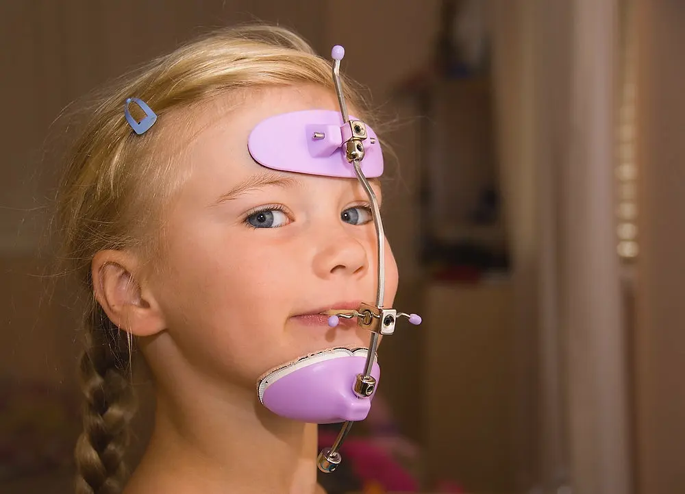 Blonde girl in a purple orthodontic face mask at Limestone Hills Orthodontics in Austin, TX, for dental or jaw correction.