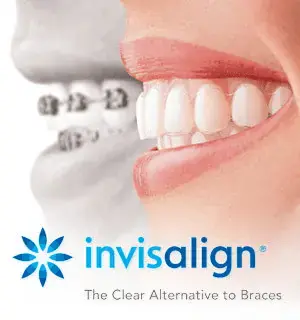 Comparison of factors influencing the effectiveness of braces versus Invisalign at Limestone Hills Orthodontics in Austin, TX.