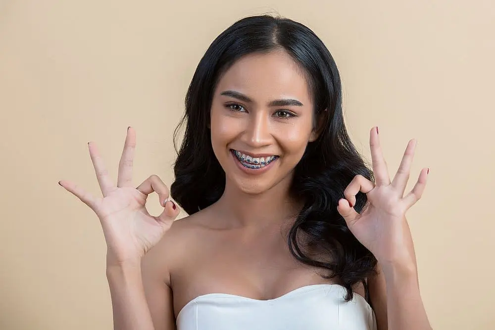 Traditional metal braces for adults at Limestone Hills Orthodontics in Austin, TX.