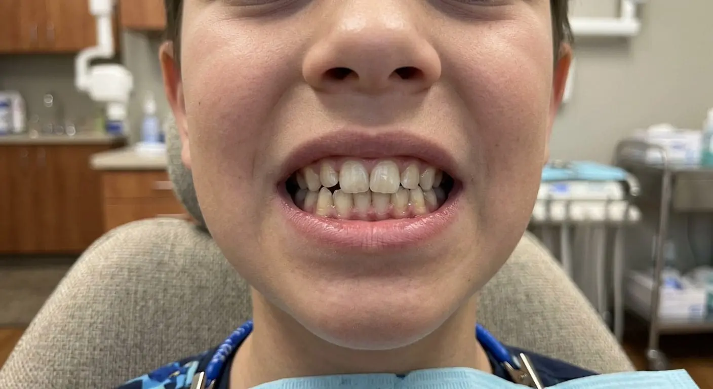 A child shows crossbite in a dental chair at Limestone Hills Orthodontics in Austin, TX; dental tools behind.