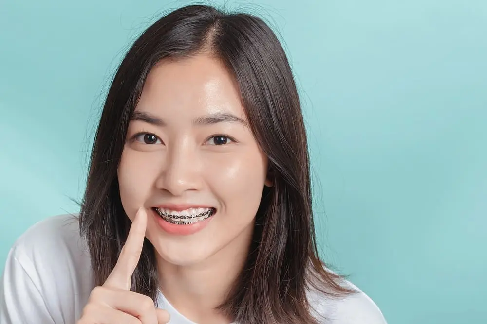 dental braces young asian woman wearing metal braces beauty smile - Ceramic Braces vs Metal Braces: Which Should You Choose?