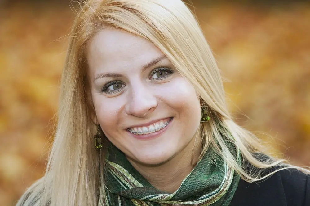 smiling blond young woman with clear braces - Aligners vs Braces: How Limestone Hills Compares Them by Case Type