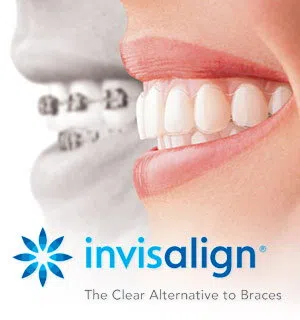 A close-up shows a smiling mouth with Invisalign aligners, contrasting with blurred traditional braces in the background. Limestone Hills Orthodontics in Austin, TX, offers Invisalign.