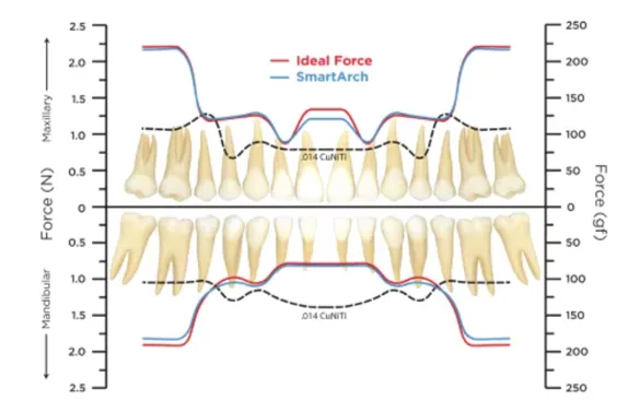 How much do braces hurt?