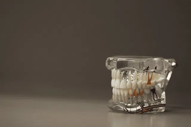 Protecting the tooth pulp is critical when performing ipr (interproximal reduction)
